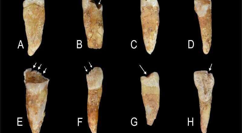 Marcas dentales como reflejo de la construcción de identidades de género en la Prehistoria